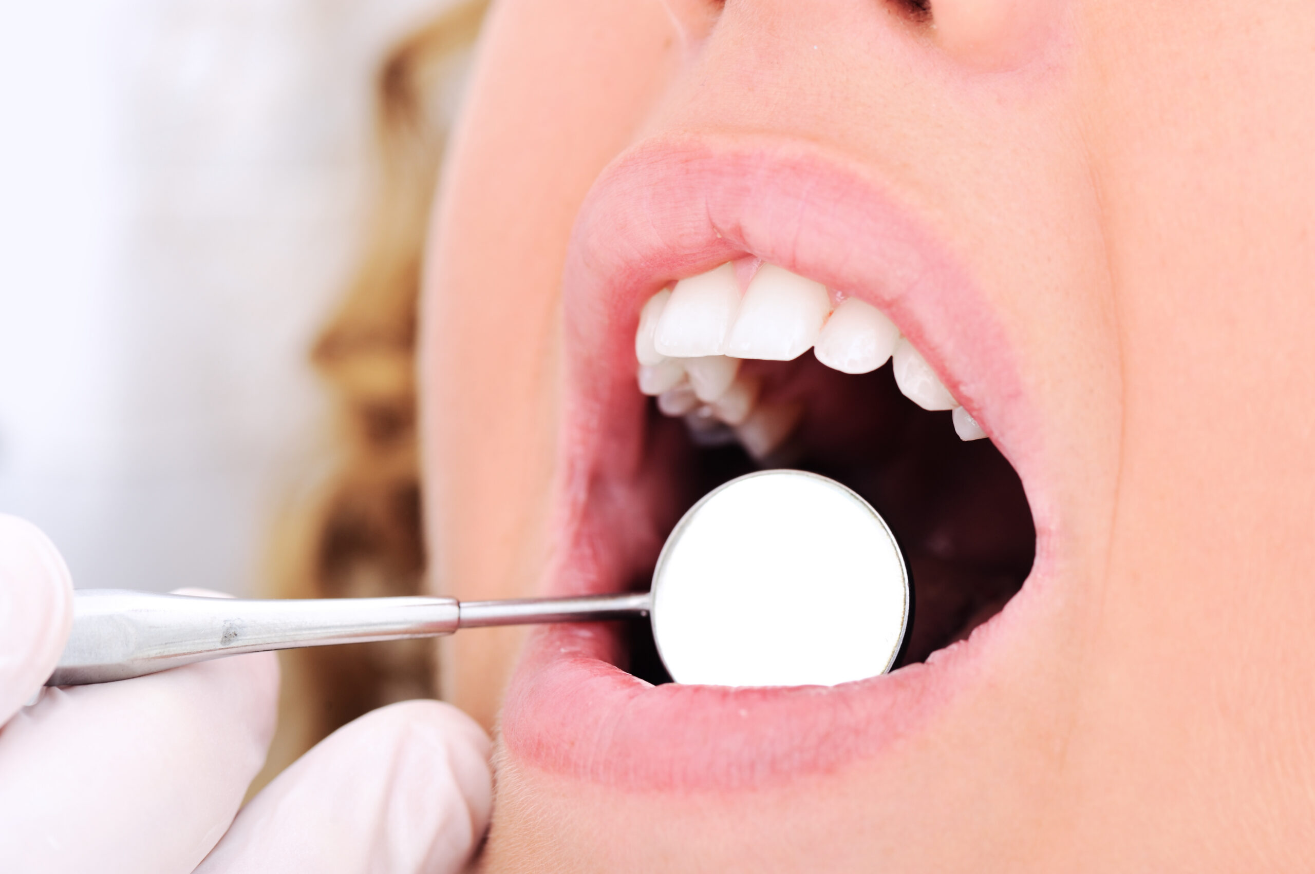 dental services